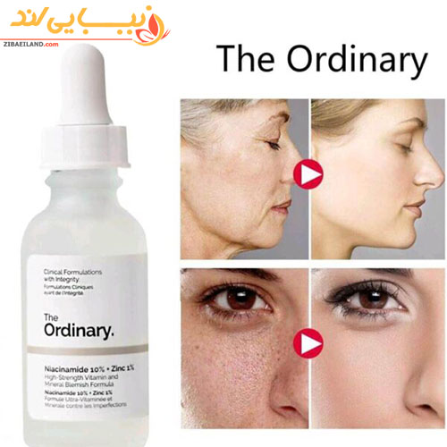 سرم نیاسینامید و زینک دی اوردینری